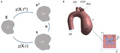 Fully-Coupled FSI Computational Analyses in the Ascending Thoracic Aorta Using Patient-Specific Conditions and Anisotropic Material Properties